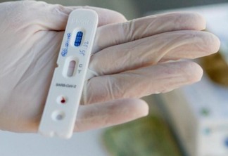 Com isso, Roraima chega a 68.509 casos confirmados para a doença, sendo 14.042 por RT-PCR e 54.467 por teste rápido. (Foto: Divulgacão)