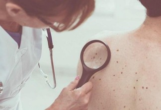 De acordo com Secretaria Estadual de Saúde (Sesau) foram registrados 1.431 casos de câncer, dos quais 835 eram de pele, um total de 58,3% (Foto: Divulgação)
