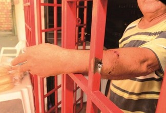 A vítima ficou ferida no braço; a bala se alojou na grade de metal da porta do comércio (Foto: Nilzete Franco/FolhaBV)