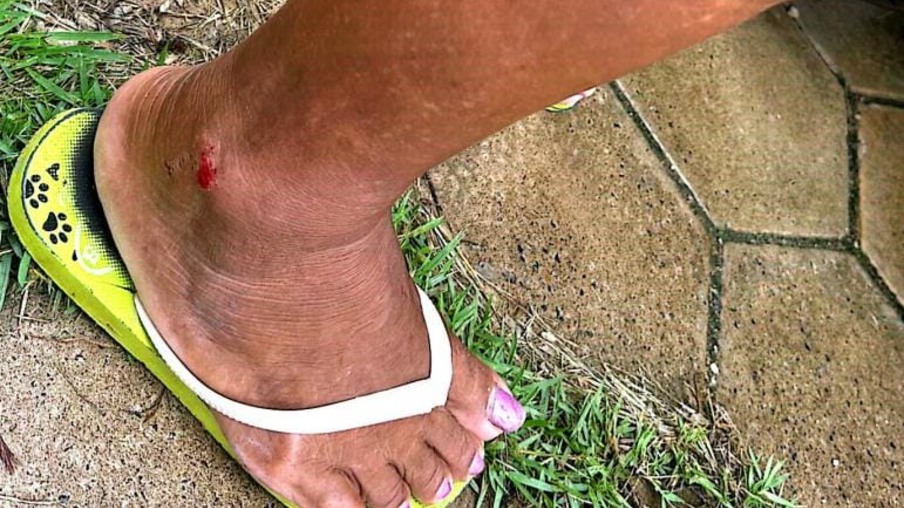 A idosa teve um ferimento no tornozelo e cotovelo (Foto: Divulgação) 