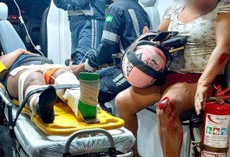 A motociclista sofreu possível fratura na perna esquerda (Foto: Divulgação)