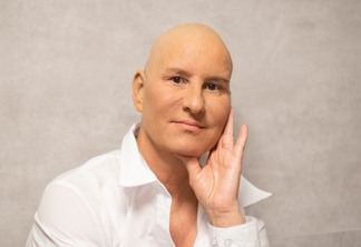 Paciente com câncer (Foto: Roland Mey/Pixabay)