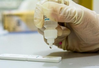 O teste rápido pode ser encontrado nas unidades de atenção primária à saúde e laboratórios particulares (Foto: Semuc/PMBV)