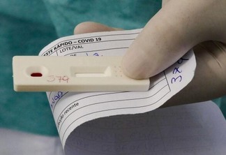 Lacen analisou 148 amostras de pacientes (Foto: Agência Brasil)