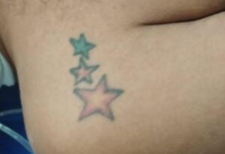 O paciente tem tatuagem de estrelas nos dois ombros. (Foto: Divulgação)