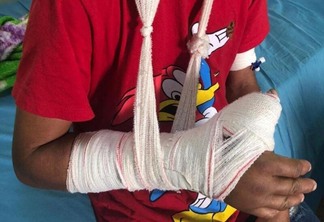 Fernando sofreu um acidente e precisa fazer uma cirurgia na mão (Foto: Arquivo pessoal)