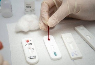 Dos 66.221 casos confirmados, 13.258 foram por RT-PCR e 52.963 pelo teste rápido (Foto: Divulgação)