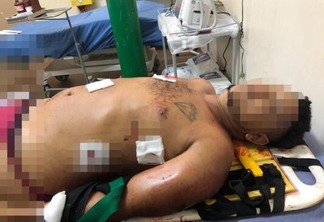 Richards dos Santos Aroucha morreu no hospital do município depois de ser baleado (Foto: Divulgação)