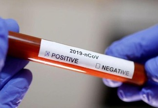Na última quarta-feira, a Organização Mundial da Saúde (OMS) declarou pandemia de coronavírus (Foto: pixaBAY)