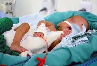 A UTI neonatal atende bebês prematuros (Foto: Nilzete Franco/FolhaBV)