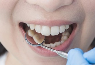 Ela diz quais os procedimentos são classificados como urgência pela odontologia (Foto: Divulgação)