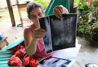 Marilene sofre com constantes dores por conta de pedras que estão nos seus rins (Foto: Diane Sampaio/FolhaBV)