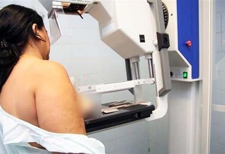 O mamógrafo novo deve entrar em funcionamento, assim que forem realizadas as adaptações estruturais necessárias na sala onde equipamento será instalado. (Foto: Divulgação)