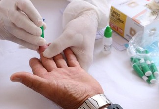 Brasil utiliza 2 tipos de testes para detectar o vírus: o RT-PCR e o antígeno, conhecido como “teste rápido” (Foto: Nilzete Franco/FolhaBV)