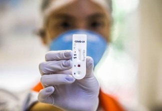 Medida não vale para testes realizados em farmácias, apenas em hospitais e laboratórios  (Foto: Divulgação)