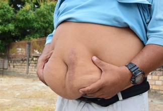 As pessoas com obesidade e que fizeram cirurgia bariátrica para perder peso, apresentaram um menor risco de desenvolver a doença.(Foto: Nilzete Franco/FolhaBV)