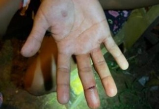 Marcas de corte no dedo médio da vítima (Foto: Divulgação)