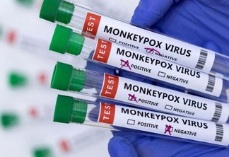 A Anvisa estabeleceu o prazo máximo de sete dias para análise de novos medicamentos e vacinas destinados ao surto da varíola dos macacos (Foto: Agência Brasil)