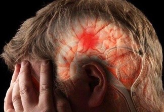O acidente vascular cerebral acontece quando se obstruem ou se rompem vasos que levam sangue ao cérebro, provocando paralisia da área cerebral que ficou sem circulação sanguínea (Foto: Divulgação)