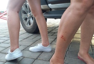 As vítimas foram atingidas nas pernas (Foto: Nilzete Franco/Folha BV)