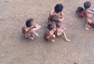 Crianças e adultos sofrem com a desnutrição (Foto: Reprodução/Instagram/urihiyanomami)